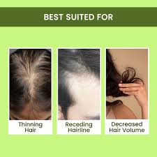 Rosemary Water, Hair Spray For Regrowth (Pack of 3)